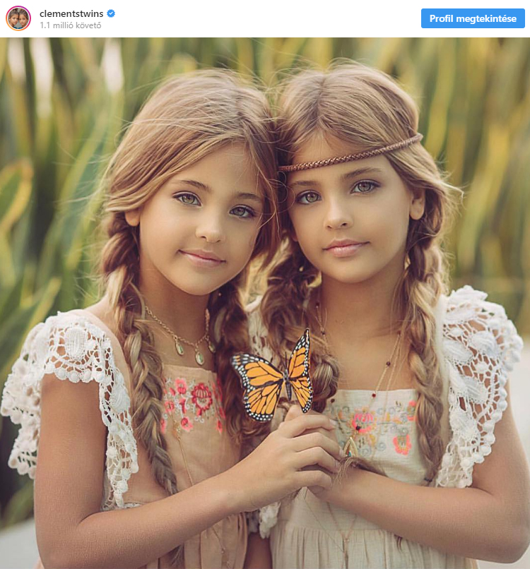 Íme, a világ legszebb ikerpárja! - Még csak 8 évesek, de már több mint 1 millió követőjük van az Instagramon