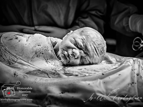 Az Év szülésfotója 2017: 12 gyönyörű fotó a szülés és születés csodájáról - Nézd meg, kiket díjazott a zsűri