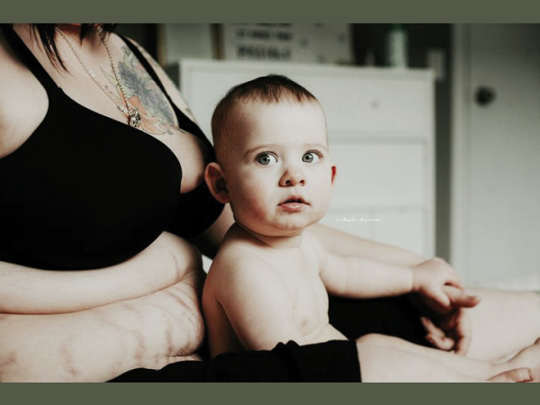 Fotók! Így változik meg a női test szülés után - Anyukák, akik nem féltek megmutatni a valóságot