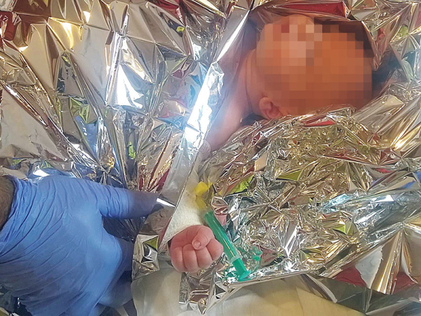 Hajszárítóval égette meg hasfájós kisbabáját egy magyar apuka - A csecsemőt az intenzívre kellett szállítani