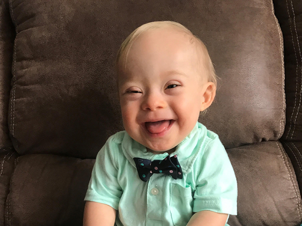 Ezt a mosolygós Down-szindrómás kisfiút választották az év babájának! - Ilyenre eddig nem volt példa