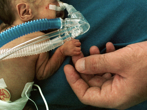 Életben maradt a 24. hétre, 500 grammal született kisbaba! - Ilyenre még nem volt példa eddig a nagyszebeni kórházban