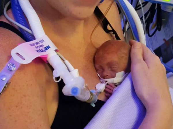 Életben maradt a 24. hétre született kisbaba! Az orvosok szinte lemondtak róla, de ő nem adta fel