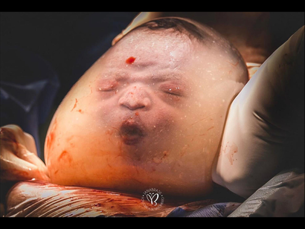 Év szülésfotója 2020: 10 gyönyörű fotó a szülés és születés csodájáról! - Ezeket díjazta idén a zsűri és a szavazóközönség