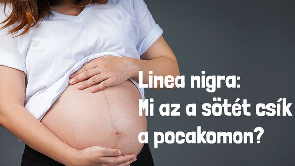 Linea nigra: az a bizonyos sötét csík a hason a terhesség alatt - Mit kell róla tudni?
