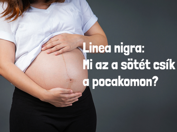 Linea nigra: az a bizonyos sötét csík a hason a terhesség alatt - Mit kell róla tudni?