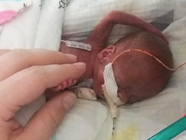 Életben maradt a 21. hétre, 340 grammal született kisfiú - Az orvosok nem sok esélyt láttak a túlélésre