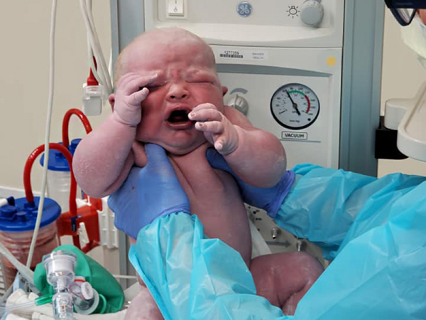 Fotók: Több mint 6 kilós óriásbaba született! - Két héttel korábban érkezett a vártnál, az orvos is meglepődött a méretén