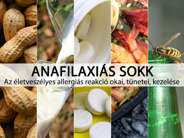 Anafilaxiás sokk: Mogyoró, darázscsípés, tej is kiválthatja az életveszéses allergiás reakciót!  - Az anafilaxia tünetei, kezelése