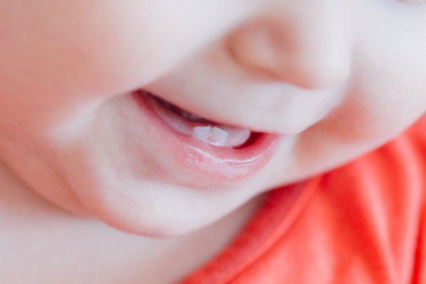 Miért fontos a csecsemőkori fogtisztítás?