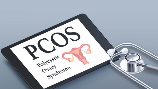 PCOS okai és kezelése